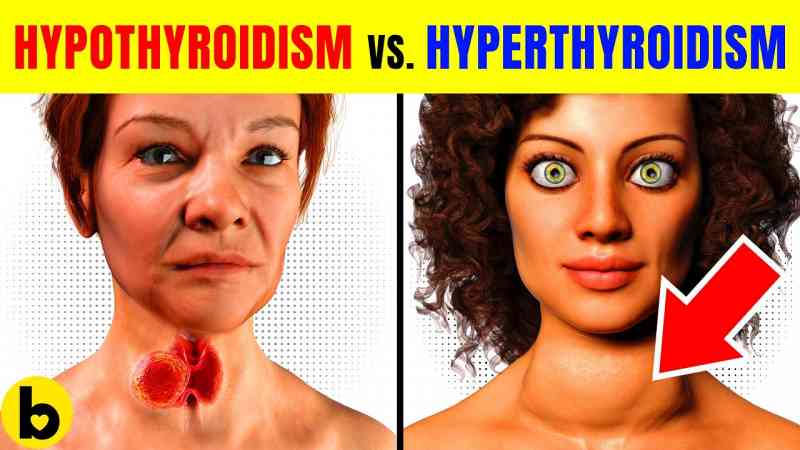 hypothyroidism-vs-hyperthyroidism-what-s-the-difference