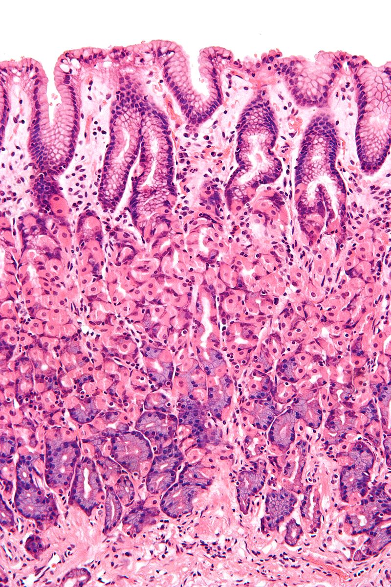 800px-normal_gastric_mucosa_intermed_mag